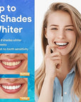Teeth Whitening Device