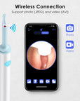 Wireless Ear Wax Removal